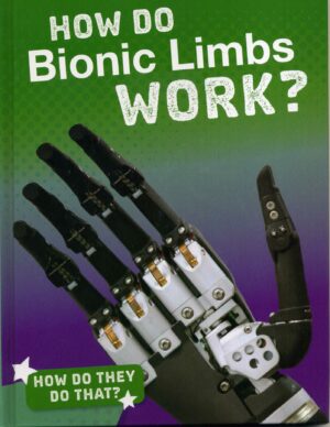 How Do Bionic Limbs Work?